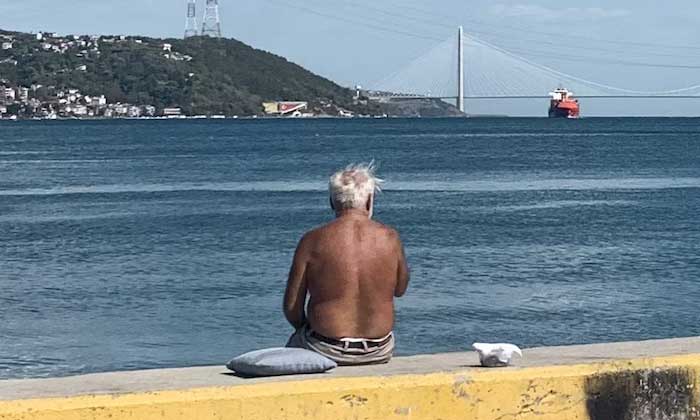the sting of sunburn