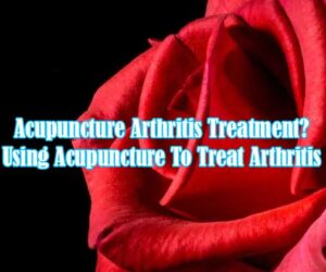 acupuncture arthritis treatment