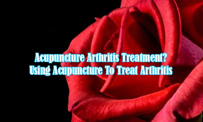 acupuncture arthritis treatment